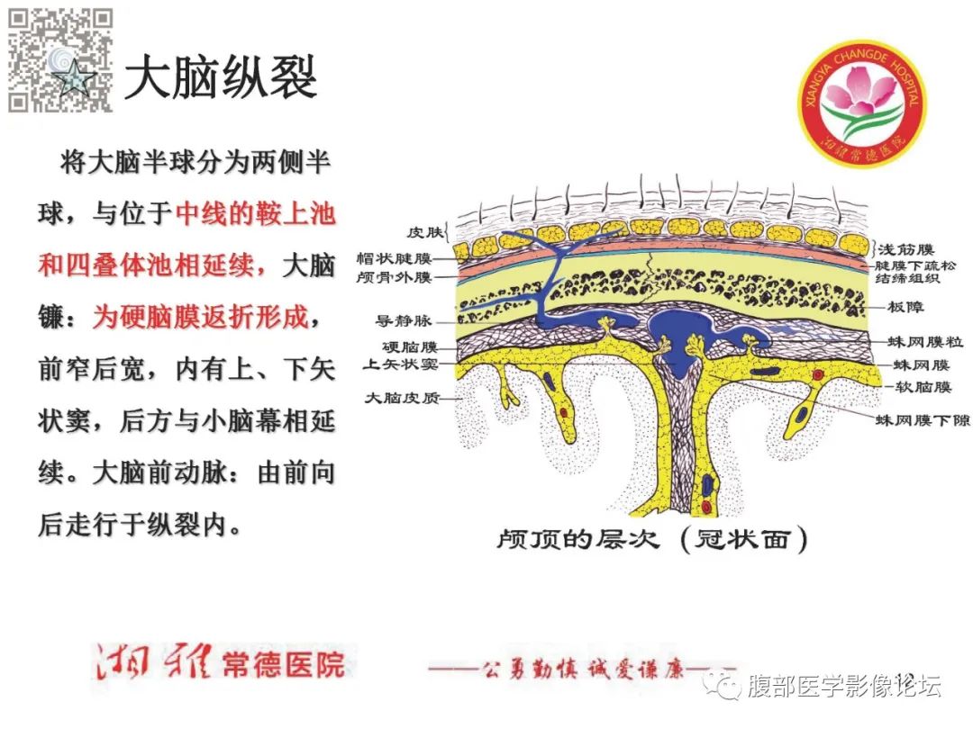 影像PPT - 【PPT】脑中线结构区域解剖及病变影像-12