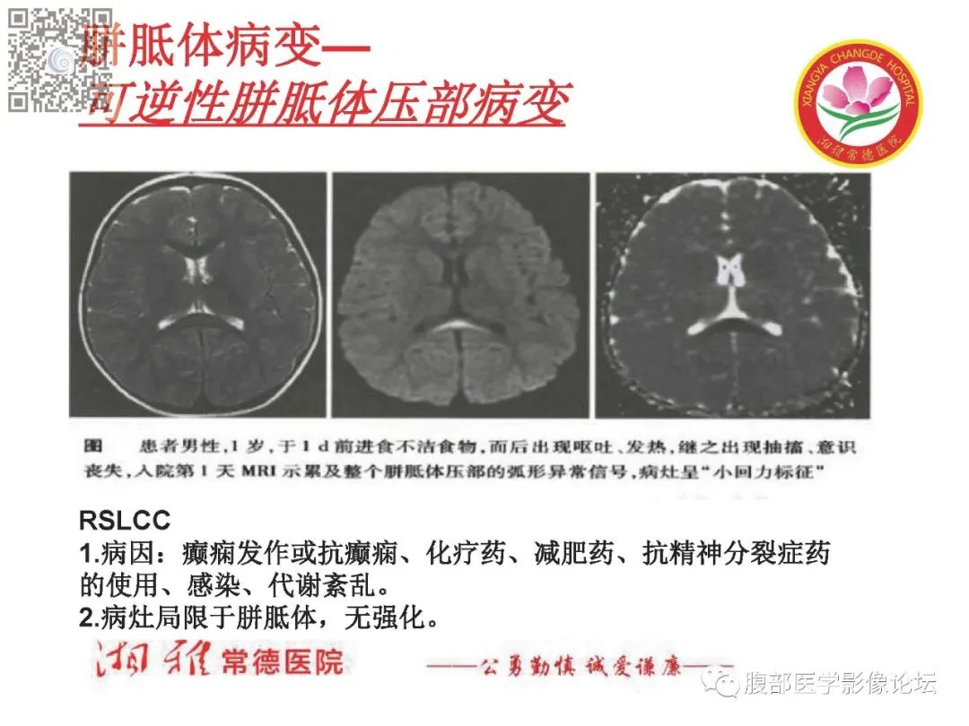 影像PPT - 【PPT】脑中线结构区域解剖及病变影像-25