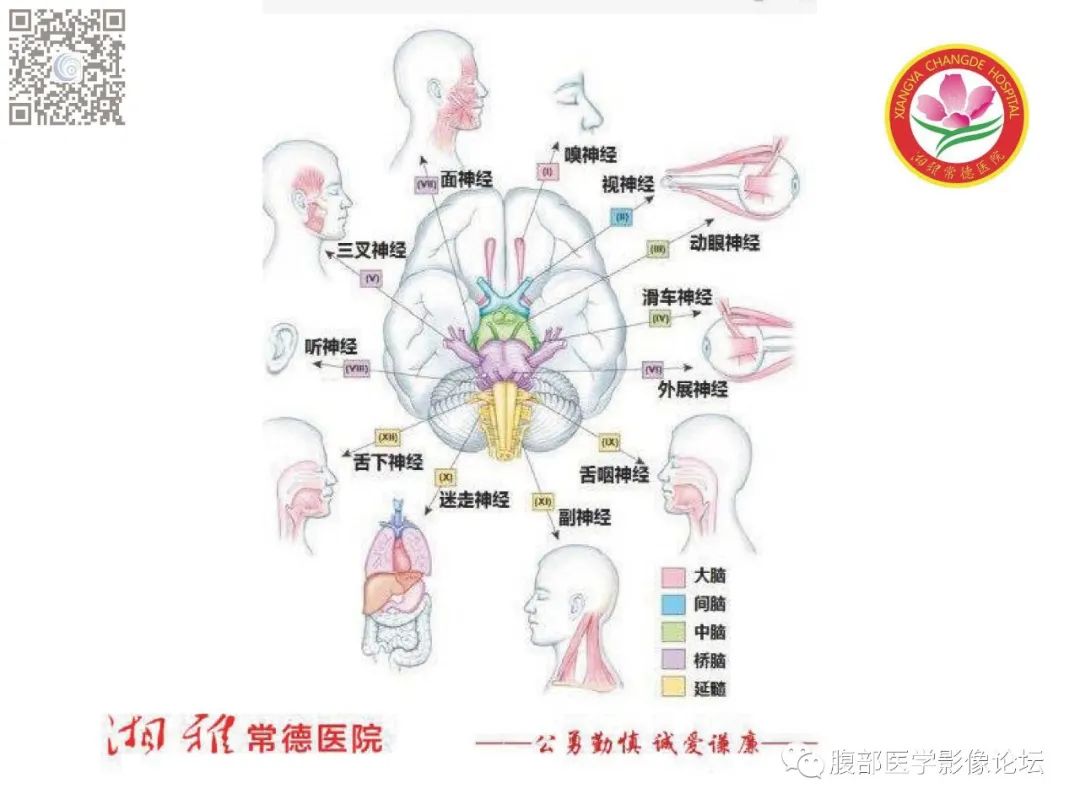 影像PPT - 【PPT】脑中线结构区域解剖及病变影像-61
