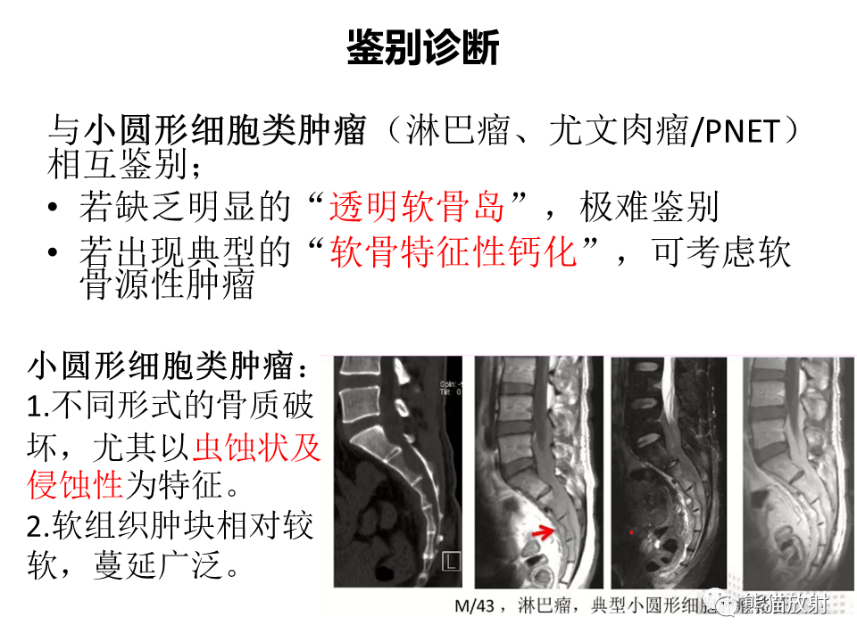 影像PPT - 【病例】骶骨骨巨细胞瘤 VS 软骨肉瘤-32