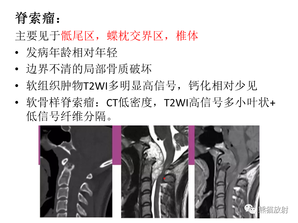 影像PPT - 【病例】骶骨骨巨细胞瘤 VS 软骨肉瘤-35