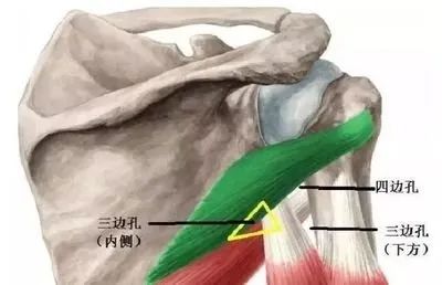 影像PPT - 四边孔综合征-6 影像PPT - 四边孔综合征-6