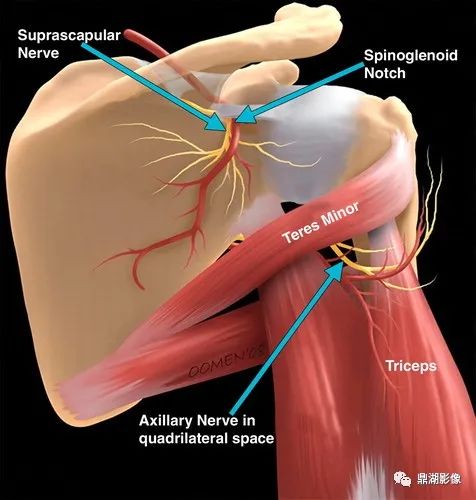 影像PPT - 四边孔综合征-7 影像PPT - 四边孔综合征-7