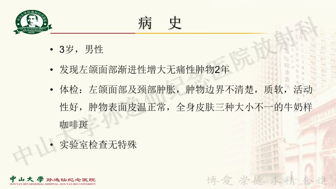 影像PPT - 【病例】颌面部丛状神经纤维瘤1例MR影像-1