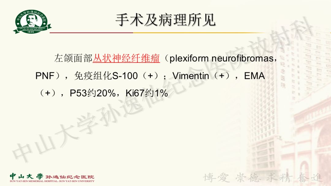 影像PPT - 【病例】颌面部丛状神经纤维瘤1例MR影像-5