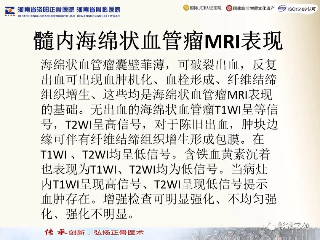 影像PPT - 【PPT】椎管内常见肿瘤MR诊断-15 影像PPT - 【PPT】椎管内常见肿瘤MR诊断-15