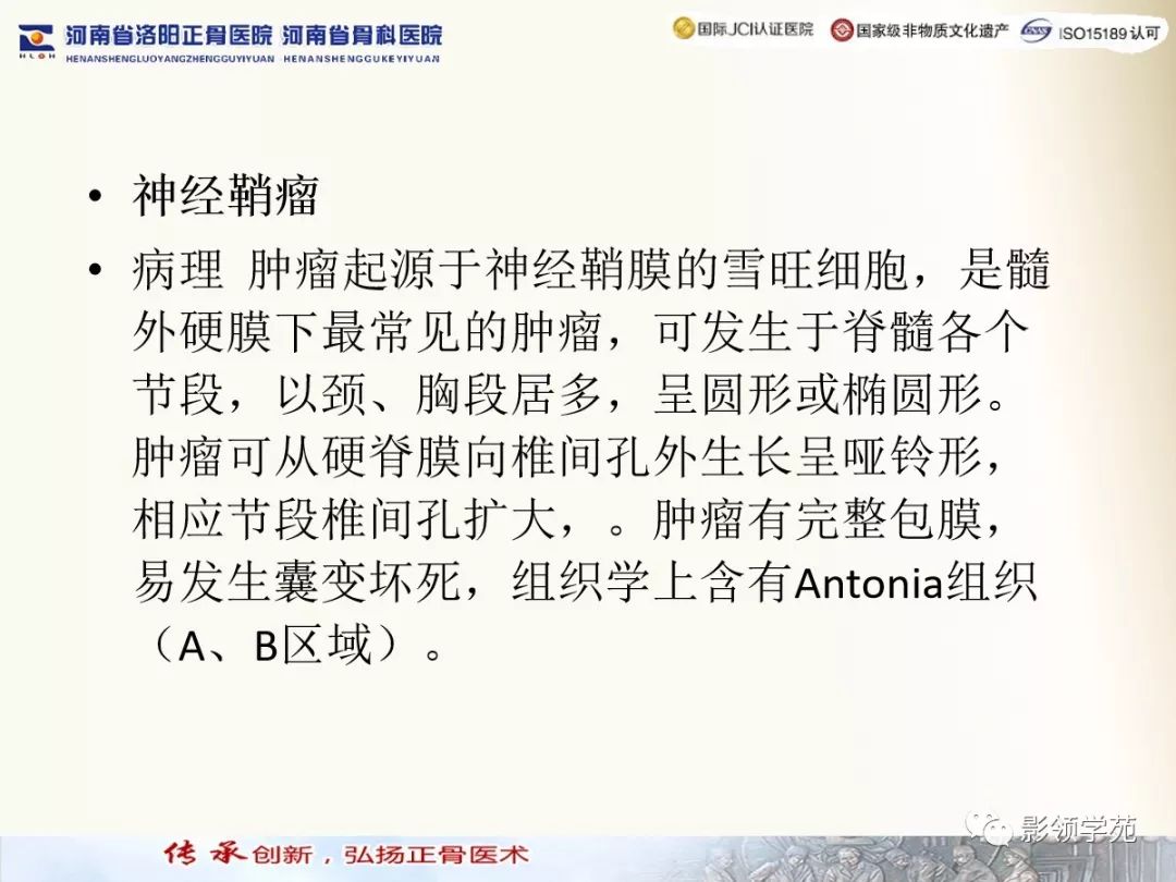 影像PPT - 【PPT】椎管内常见肿瘤MR诊断-18 影像PPT - 【PPT】椎管内常见肿瘤MR诊断-18