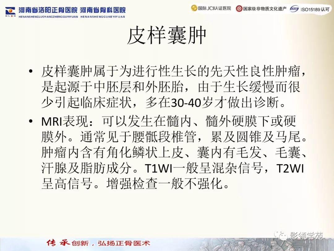 影像PPT - 【PPT】椎管内常见肿瘤MR诊断-34 影像PPT - 【PPT】椎管内常见肿瘤MR诊断-34