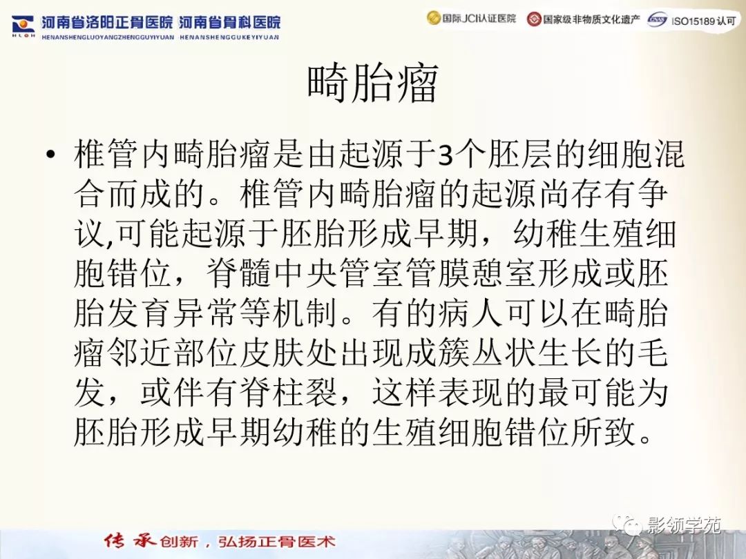 影像PPT - 【PPT】椎管内常见肿瘤MR诊断-36 影像PPT - 【PPT】椎管内常见肿瘤MR诊断-36