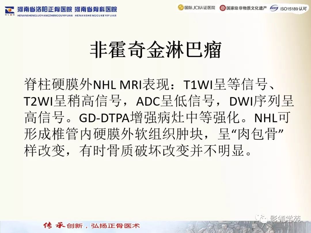 影像PPT - 【PPT】椎管内常见肿瘤MR诊断-44 影像PPT - 【PPT】椎管内常见肿瘤MR诊断-44