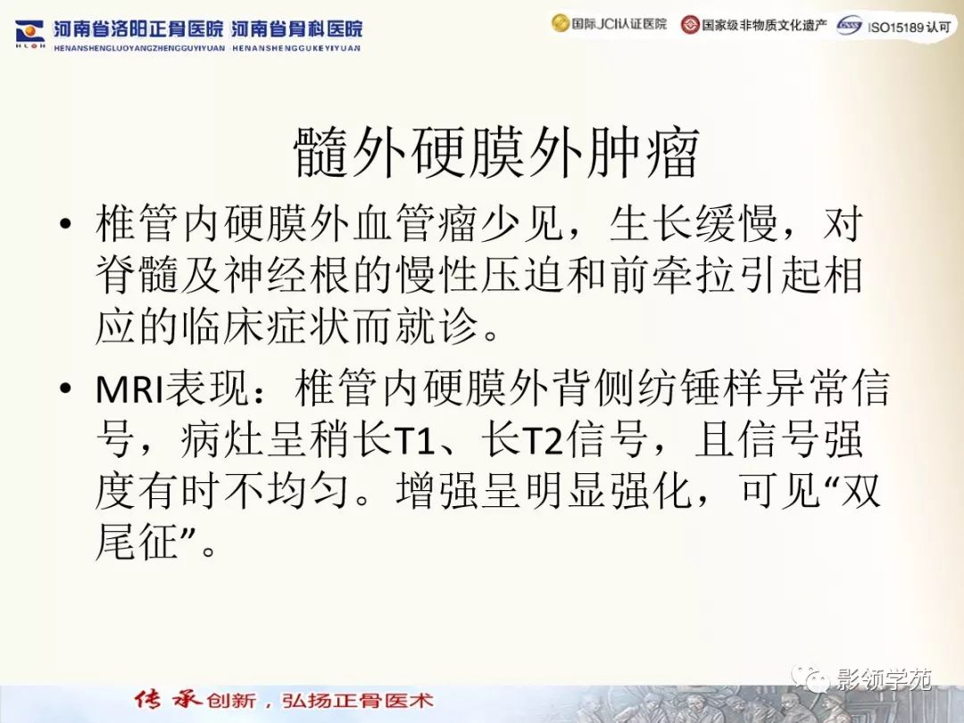 影像PPT - 【PPT】椎管内常见肿瘤MR诊断-46 影像PPT - 【PPT】椎管内常见肿瘤MR诊断-46