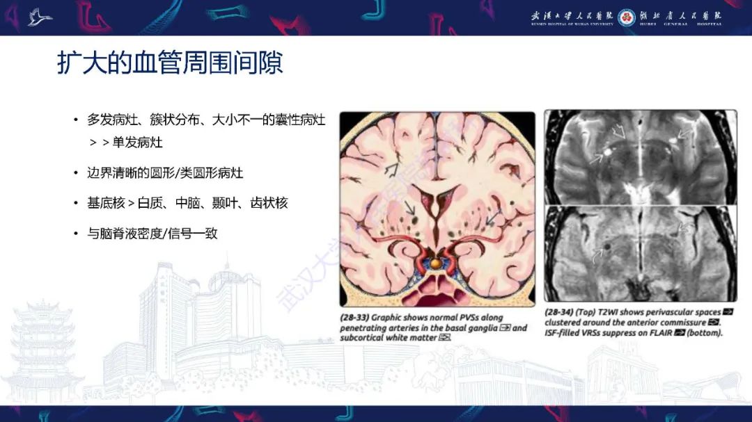 影像PPT - 【PPT】脑内单发囊性病变影像诊断-10