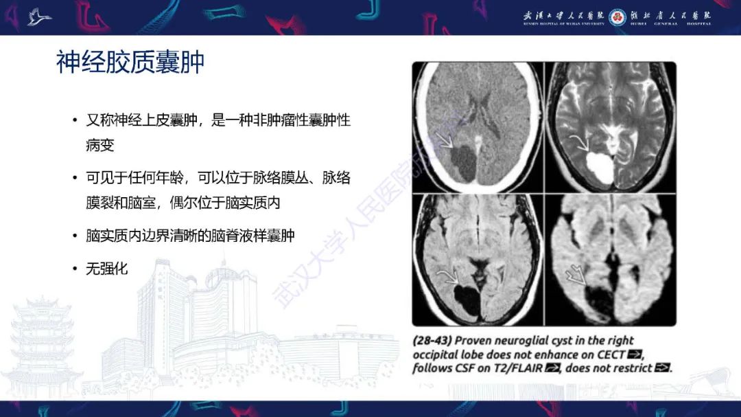 影像PPT - 【PPT】脑内单发囊性病变影像诊断-13