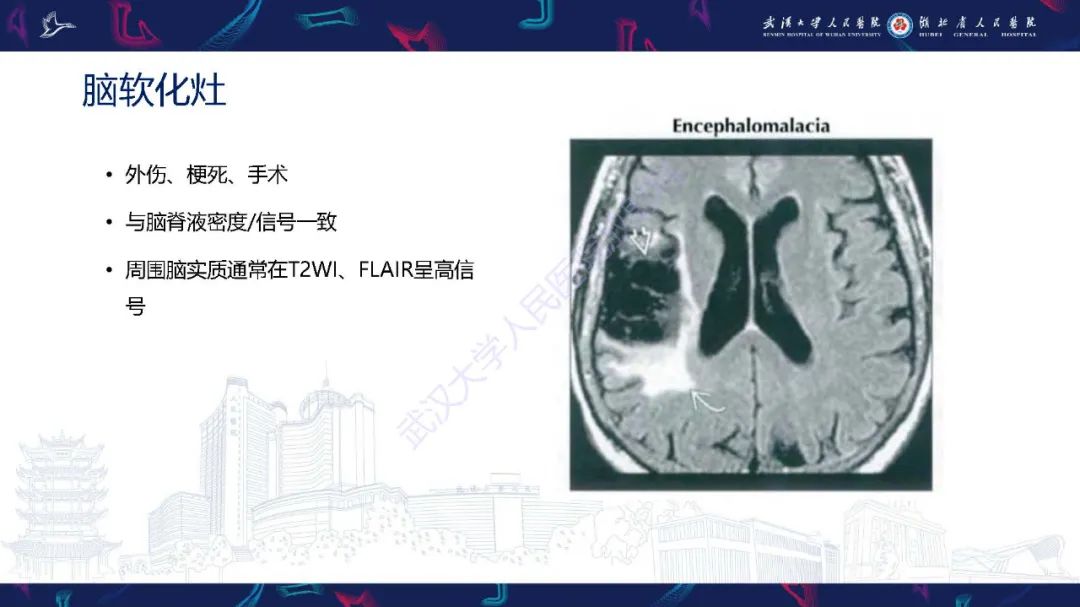 影像PPT - 【PPT】脑内单发囊性病变影像诊断-15