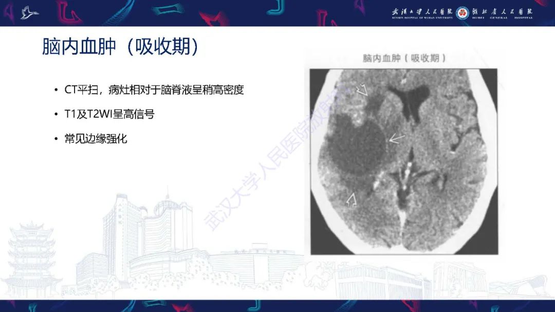 影像PPT - 【PPT】脑内单发囊性病变影像诊断-16