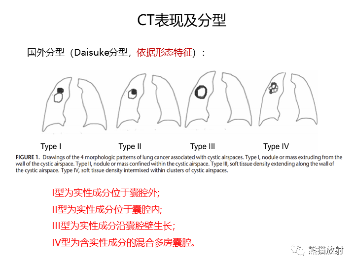 影像PPT - 【病例】肺腺癌（囊腔类肺癌）VS 肺局灶碳末沉积-18