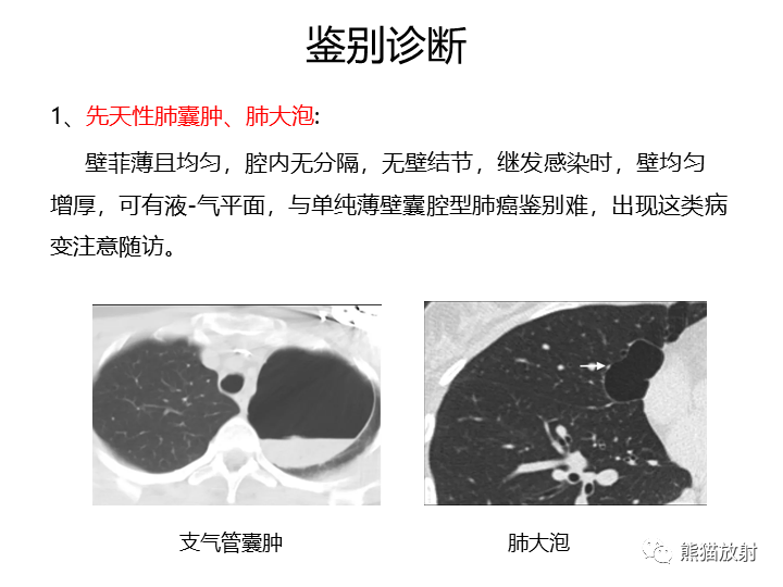 影像PPT - 【病例】肺腺癌（囊腔类肺癌）VS 肺局灶碳末沉积-27