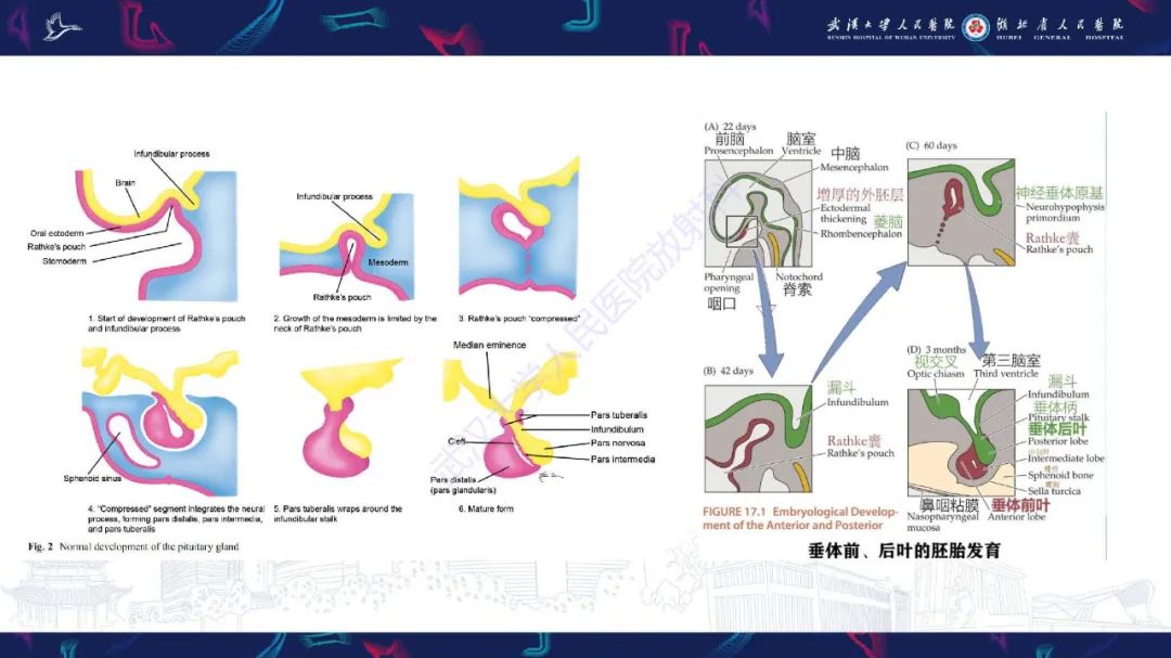 影像PPT - 【PPT】儿童鞍区病变磁共振诊断-8