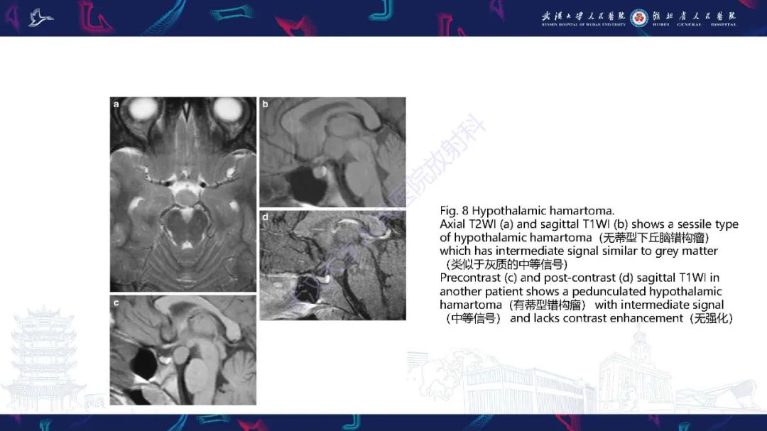 影像PPT - 【PPT】儿童鞍区病变磁共振诊断-20