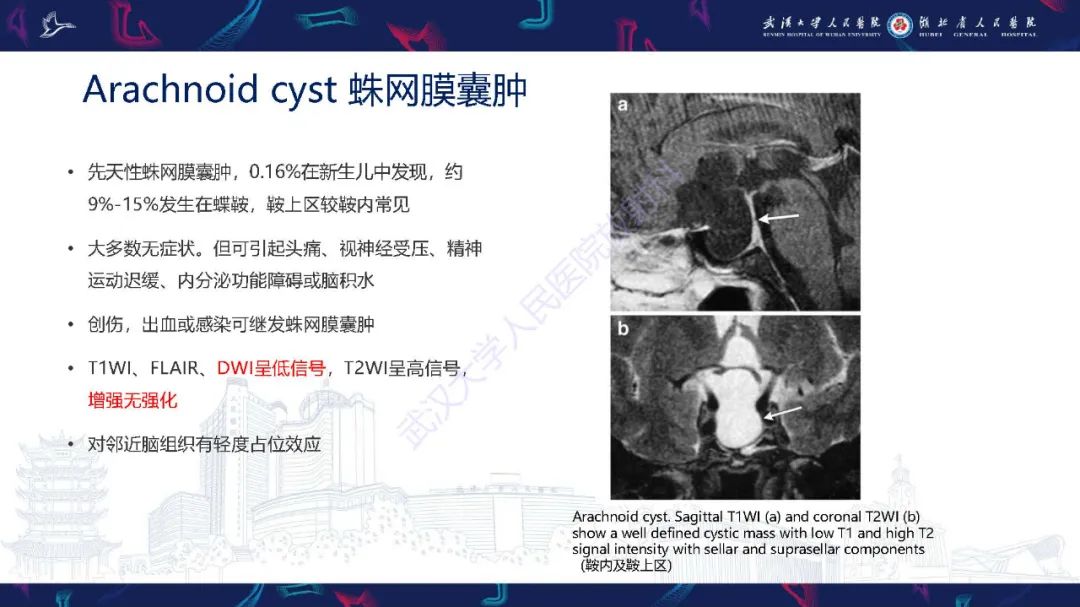 影像PPT - 【PPT】儿童鞍区病变磁共振诊断-30