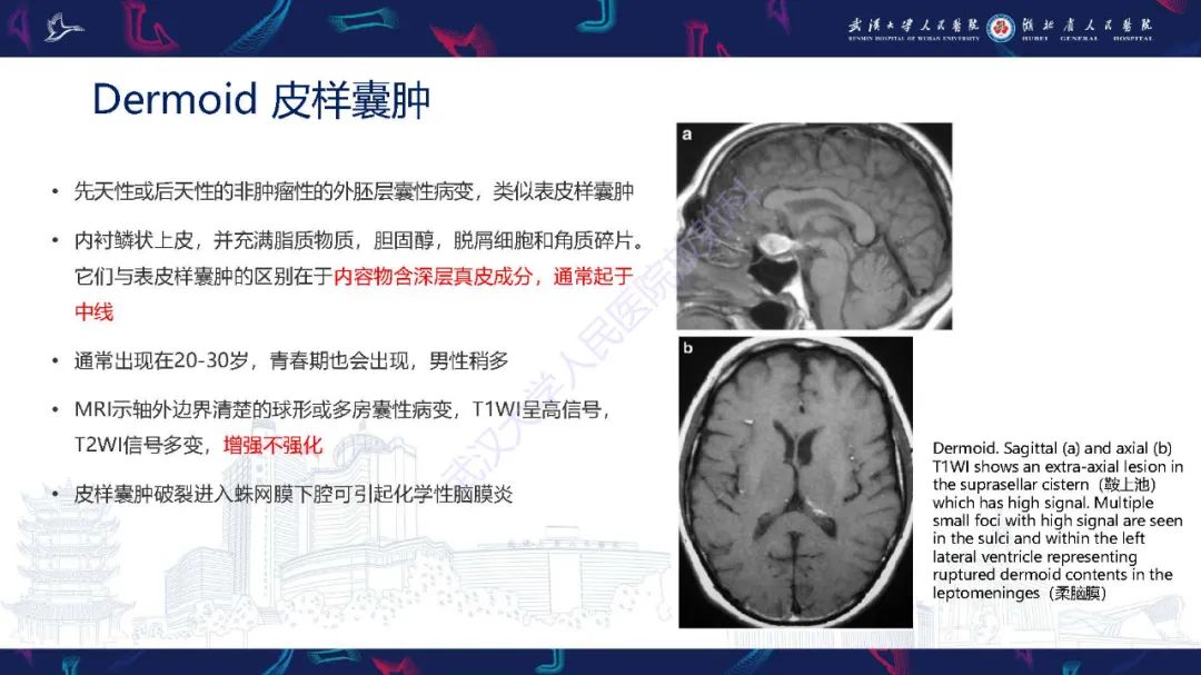 影像PPT - 【PPT】儿童鞍区病变磁共振诊断-29