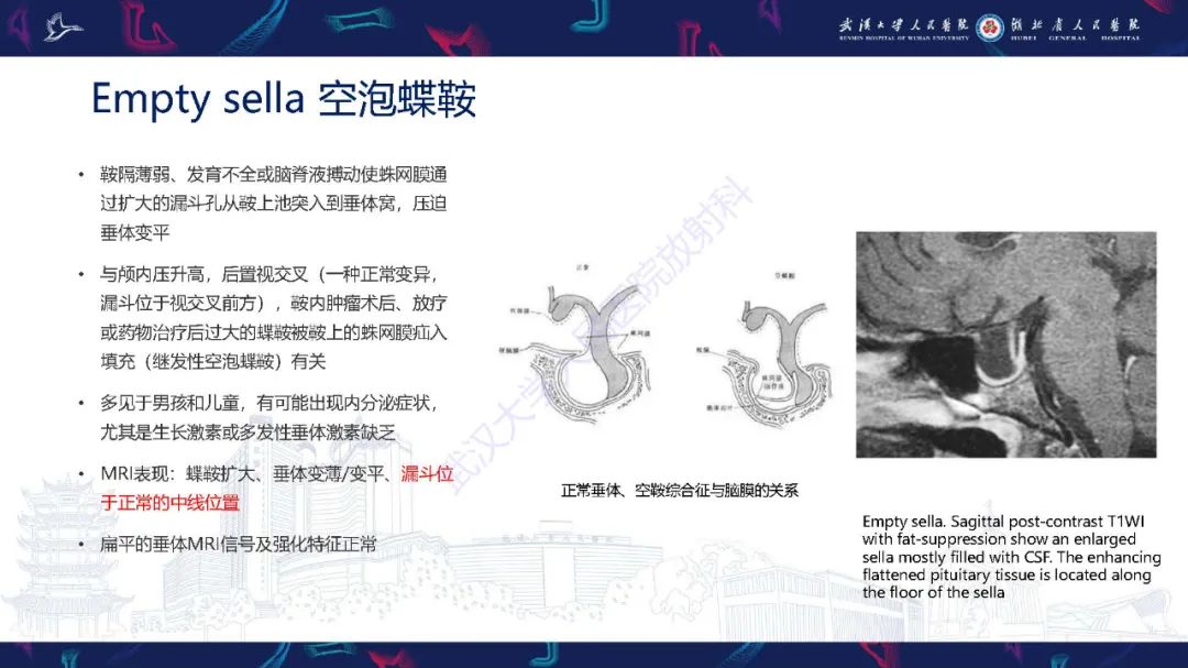 影像PPT - 【PPT】儿童鞍区病变磁共振诊断-32