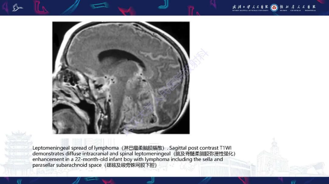 影像PPT - 【PPT】儿童鞍区病变磁共振诊断-61
