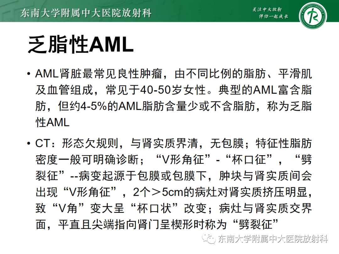 影像PPT - 【PPT】肾嗜酸细胞腺瘤的影像-20