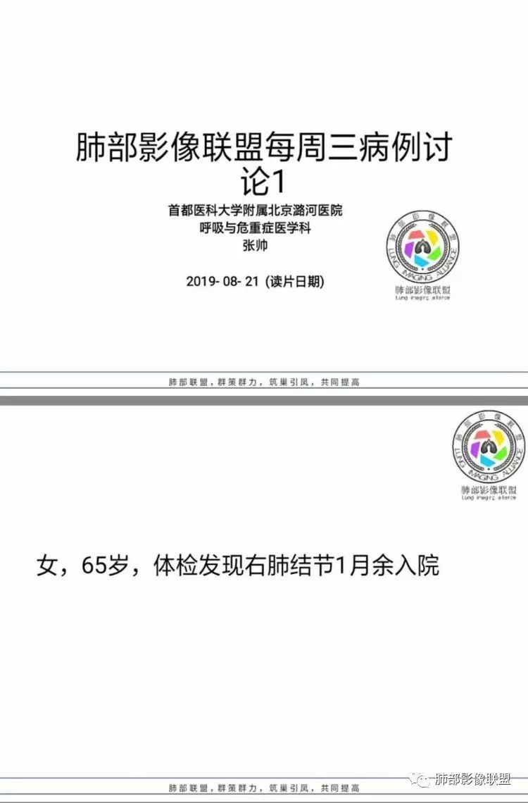 影像PPT - 【病例】硬化性肺细胞瘤1例CT影像-1 影像PPT - 【病例】硬化性肺细胞瘤1例CT影像-1