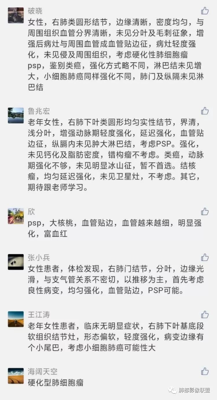 影像PPT - 【病例】硬化性肺细胞瘤1例CT影像-17 影像PPT - 【病例】硬化性肺细胞瘤1例CT影像-17