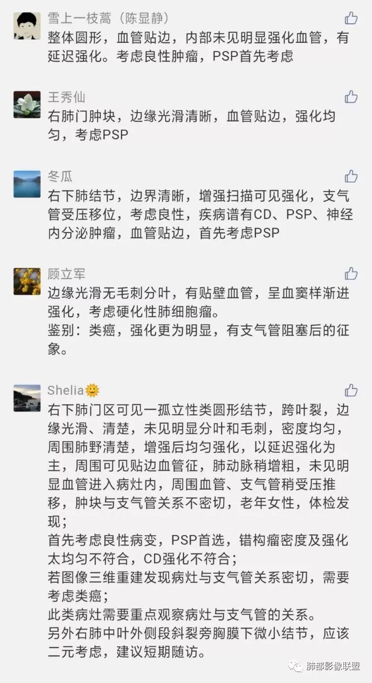 影像PPT - 【病例】硬化性肺细胞瘤1例CT影像-18 影像PPT - 【病例】硬化性肺细胞瘤1例CT影像-18