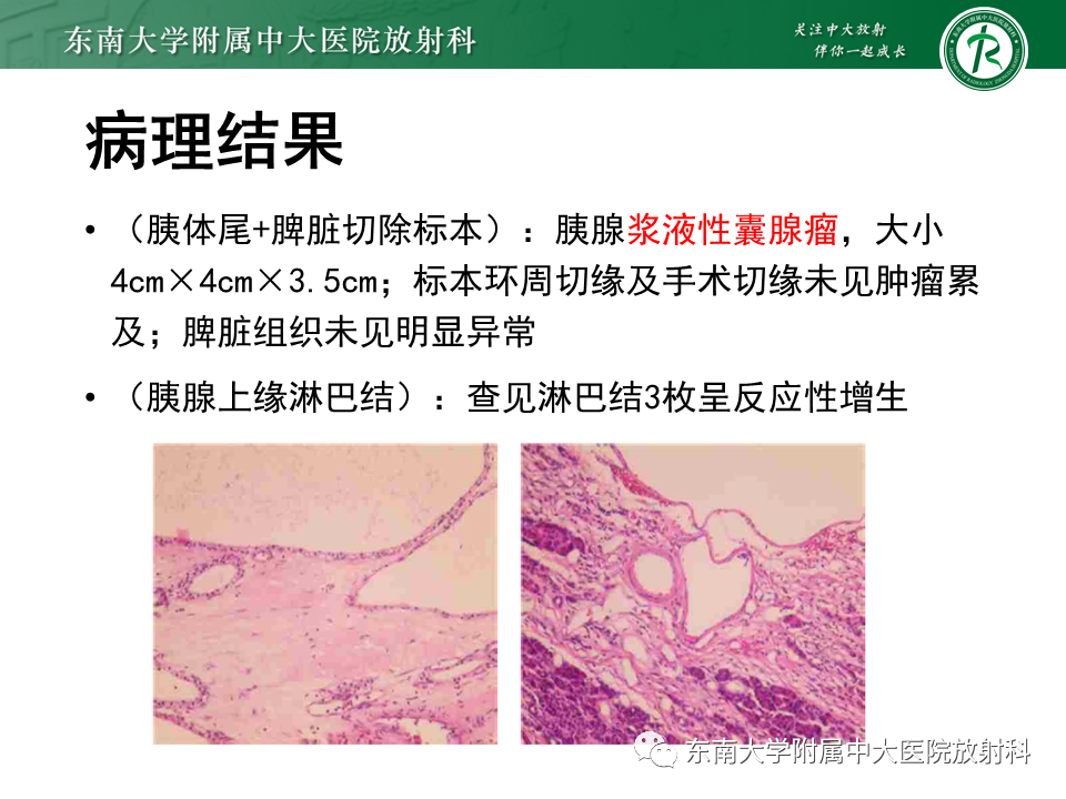影像PPT - 【PPT】胰腺常见囊性病灶的鉴别诊断-4