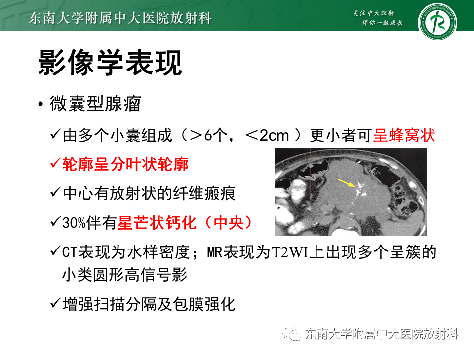 影像PPT - 【PPT】胰腺常见囊性病灶的鉴别诊断-9