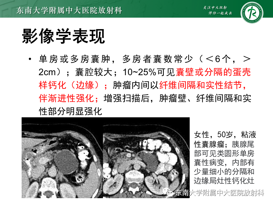 影像PPT - 【PPT】胰腺常见囊性病灶的鉴别诊断-15