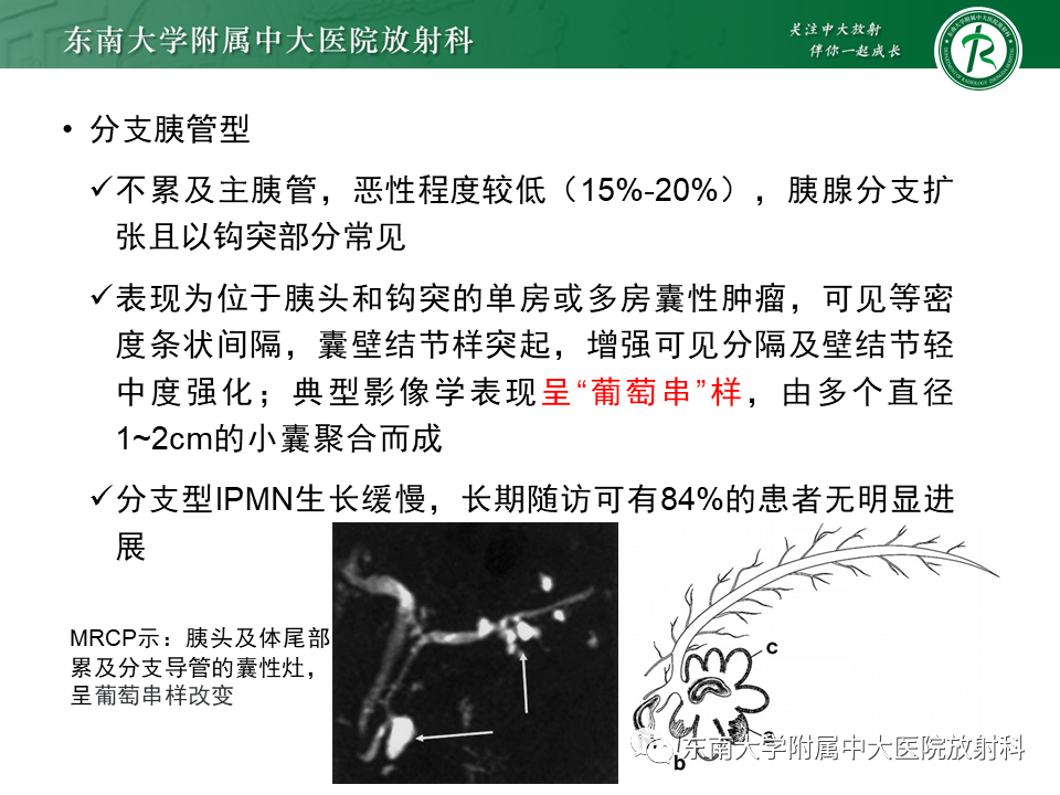影像PPT - 【PPT】胰腺常见囊性病灶的鉴别诊断-22