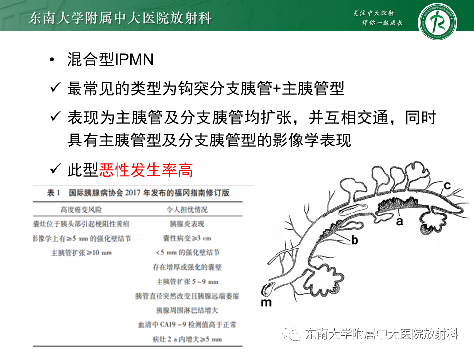影像PPT - 【PPT】胰腺常见囊性病灶的鉴别诊断-23