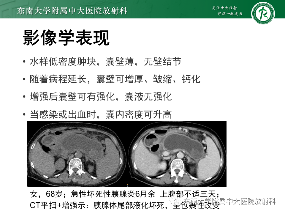 影像PPT - 【PPT】胰腺常见囊性病灶的鉴别诊断-30