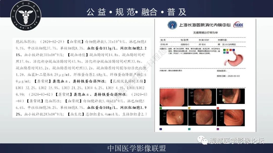 影像PPT - 【病例】小肠异位胃粘膜1例CT影像-3