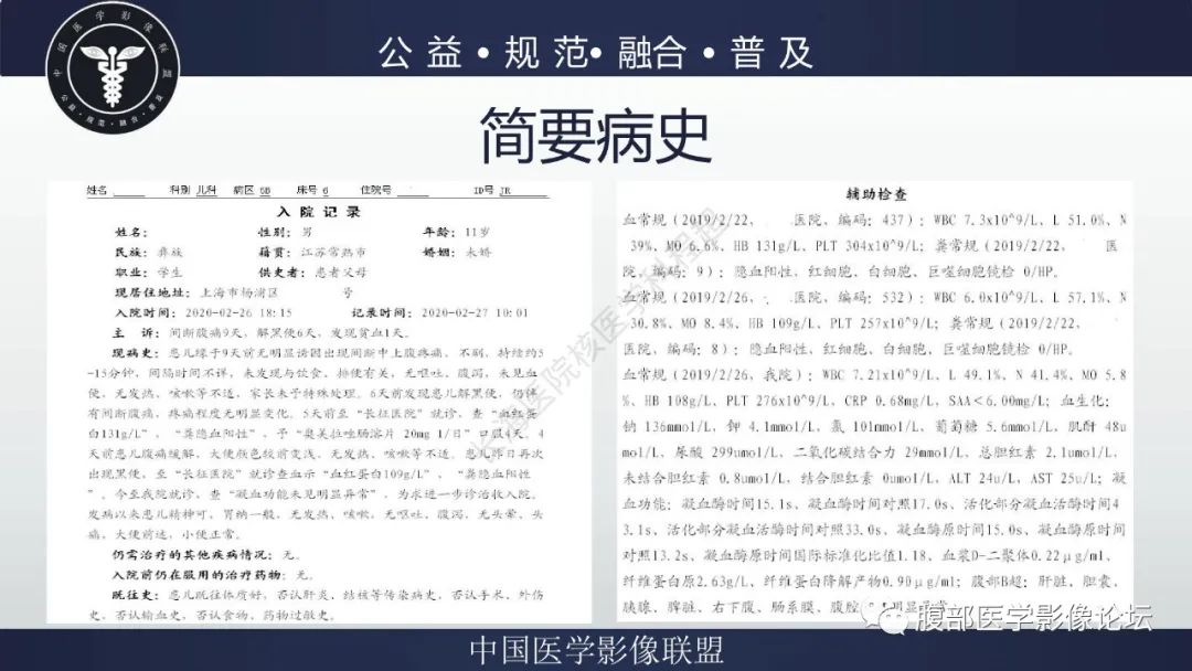 影像PPT - 【病例】小肠异位胃粘膜1例CT影像-2