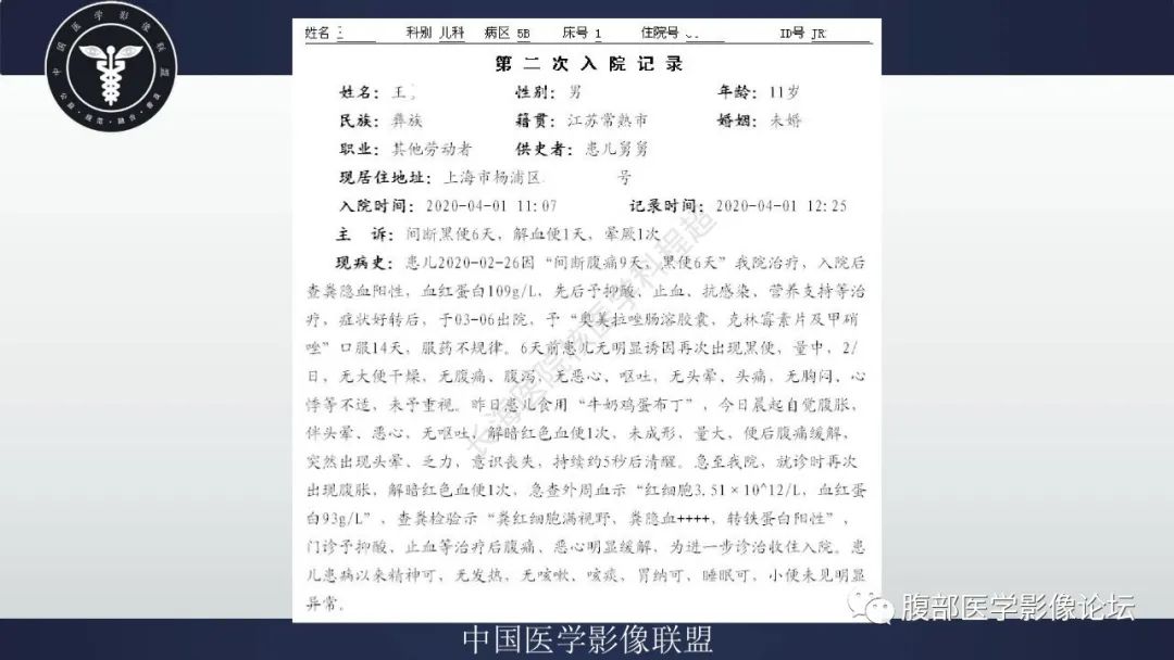 影像PPT - 【病例】小肠异位胃粘膜1例CT影像-5