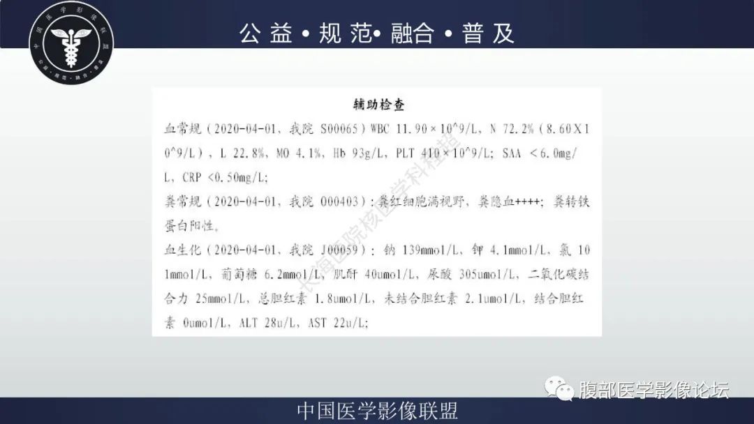 影像PPT - 【病例】小肠异位胃粘膜1例CT影像-6