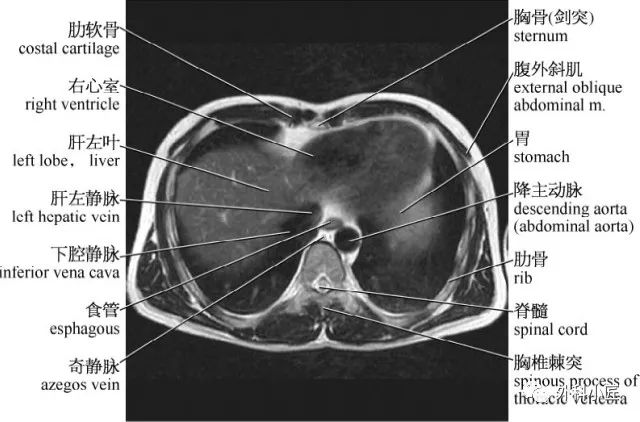 影像PPT - 46组对比图带你完全掌握腹部影像解剖-4 影像PPT - 46组对比图带你完全掌握腹部影像解剖-4