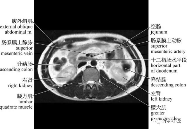 影像PPT - 46组对比图带你完全掌握腹部影像解剖-43 影像PPT - 46组对比图带你完全掌握腹部影像解剖-43