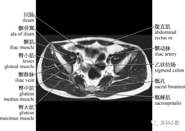 影像PPT - 46组对比图带你完全掌握腹部影像解剖-49 影像PPT - 46组对比图带你完全掌握腹部影像解剖-49