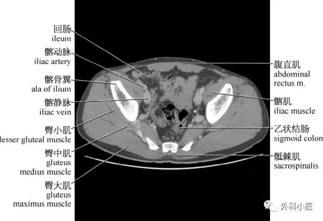 影像PPT - 46组对比图带你完全掌握腹部影像解剖-50 影像PPT - 46组对比图带你完全掌握腹部影像解剖-50