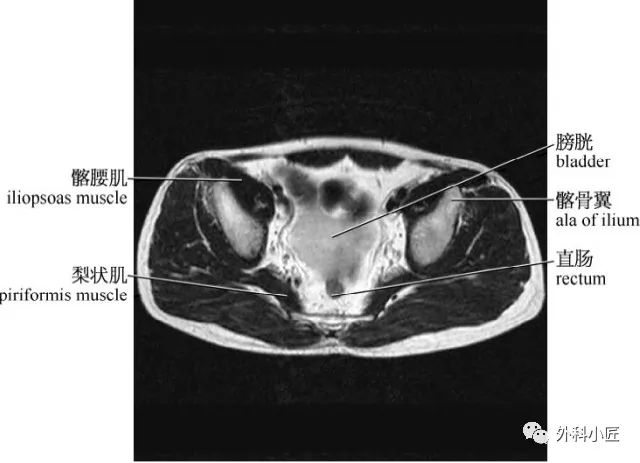 影像PPT - 46组对比图带你完全掌握腹部影像解剖-55 影像PPT - 46组对比图带你完全掌握腹部影像解剖-55