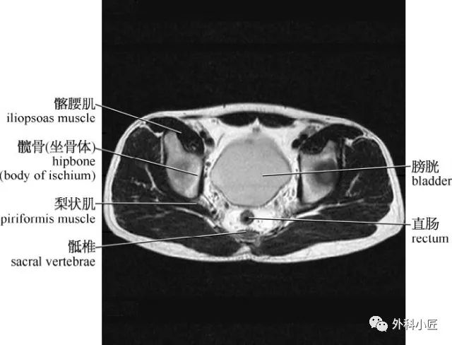 影像PPT - 46组对比图带你完全掌握腹部影像解剖-61 影像PPT - 46组对比图带你完全掌握腹部影像解剖-61