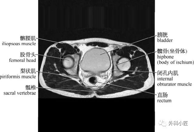 影像PPT - 46组对比图带你完全掌握腹部影像解剖-67 影像PPT - 46组对比图带你完全掌握腹部影像解剖-67