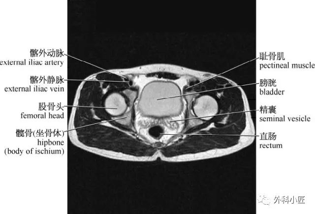 影像PPT - 46组对比图带你完全掌握腹部影像解剖-71 影像PPT - 46组对比图带你完全掌握腹部影像解剖-71