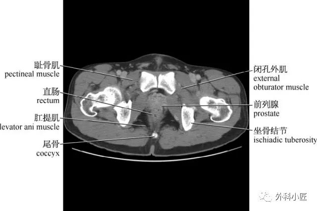 影像PPT - 46组对比图带你完全掌握腹部影像解剖-84 影像PPT - 46组对比图带你完全掌握腹部影像解剖-84
